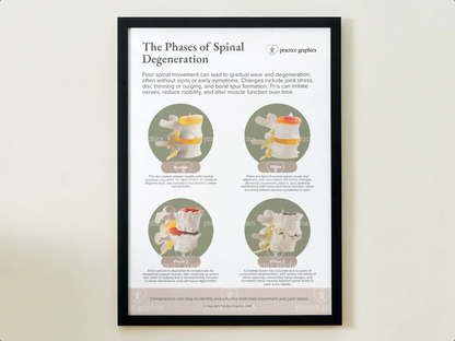 Phases of spinal degeneration Poster (Spinal Model)