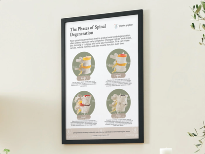 Phases of spinal degeneration Poster (Spinal Model)
