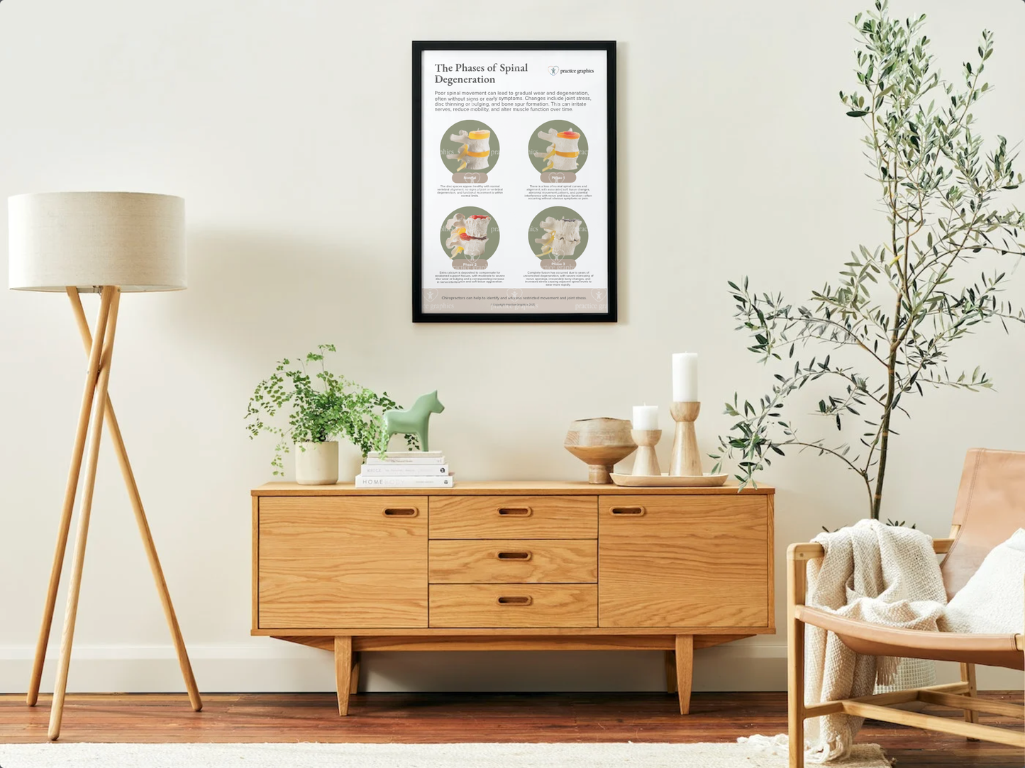 Phases of spinal degeneration Poster (Spinal Model)