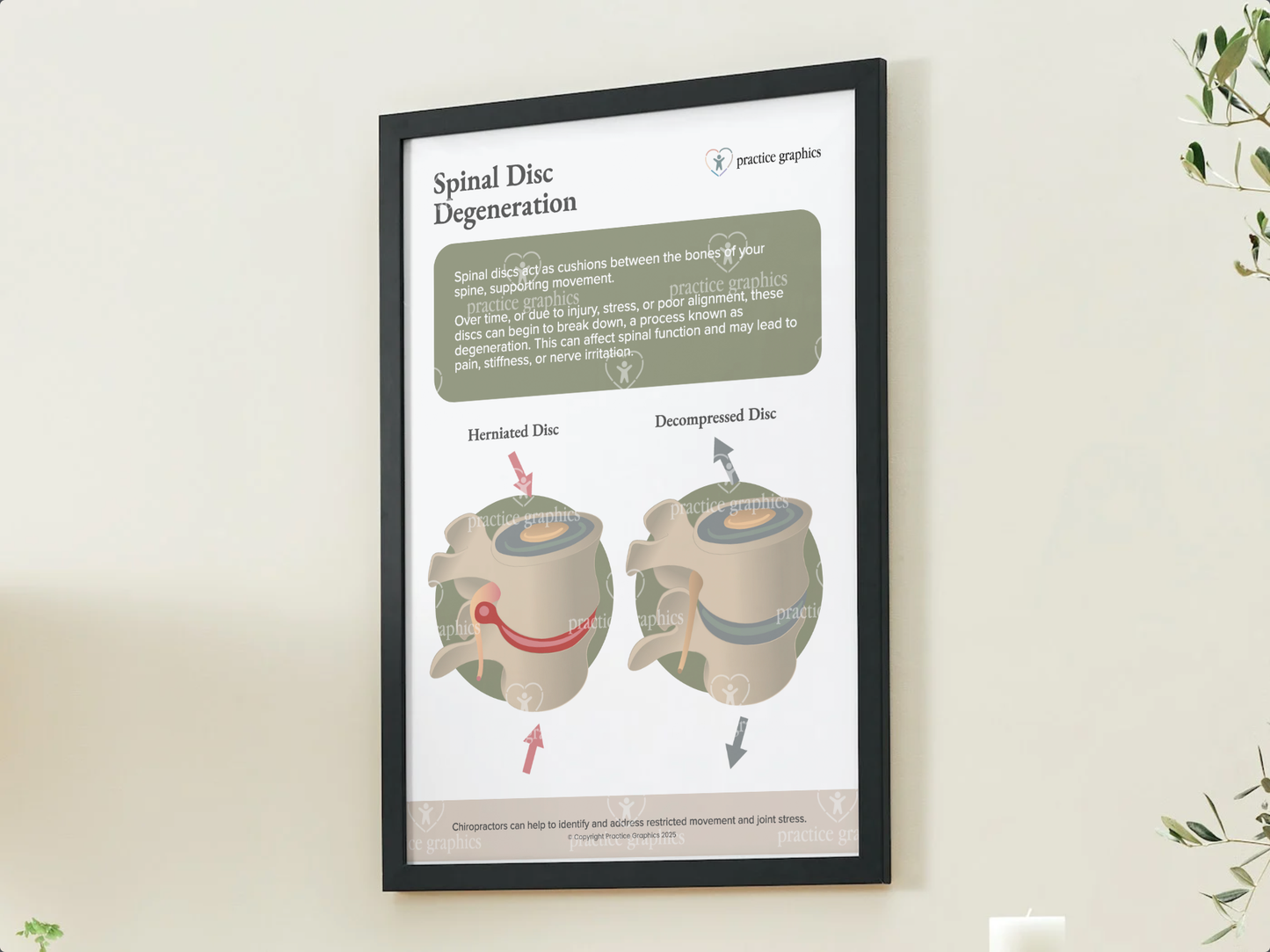 Spinal disc degeneration Poster