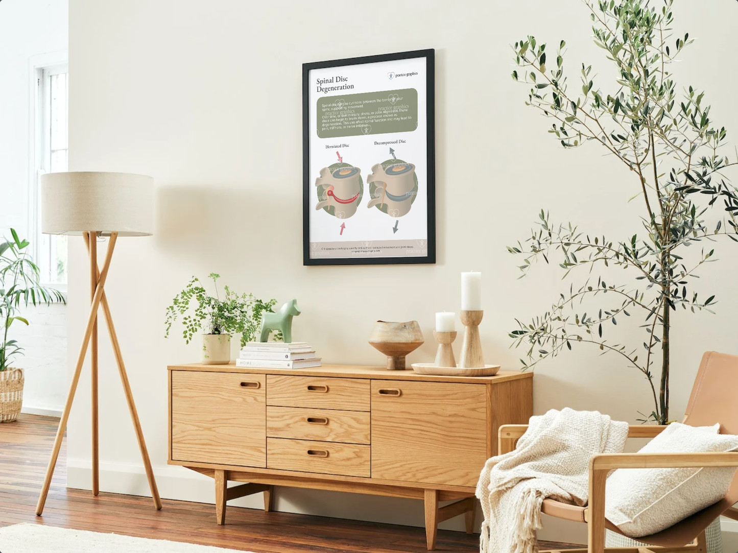 Spinal disc degeneration Poster