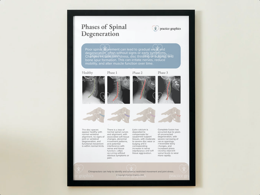 Phases of spinal degeneration Poster (xrays)