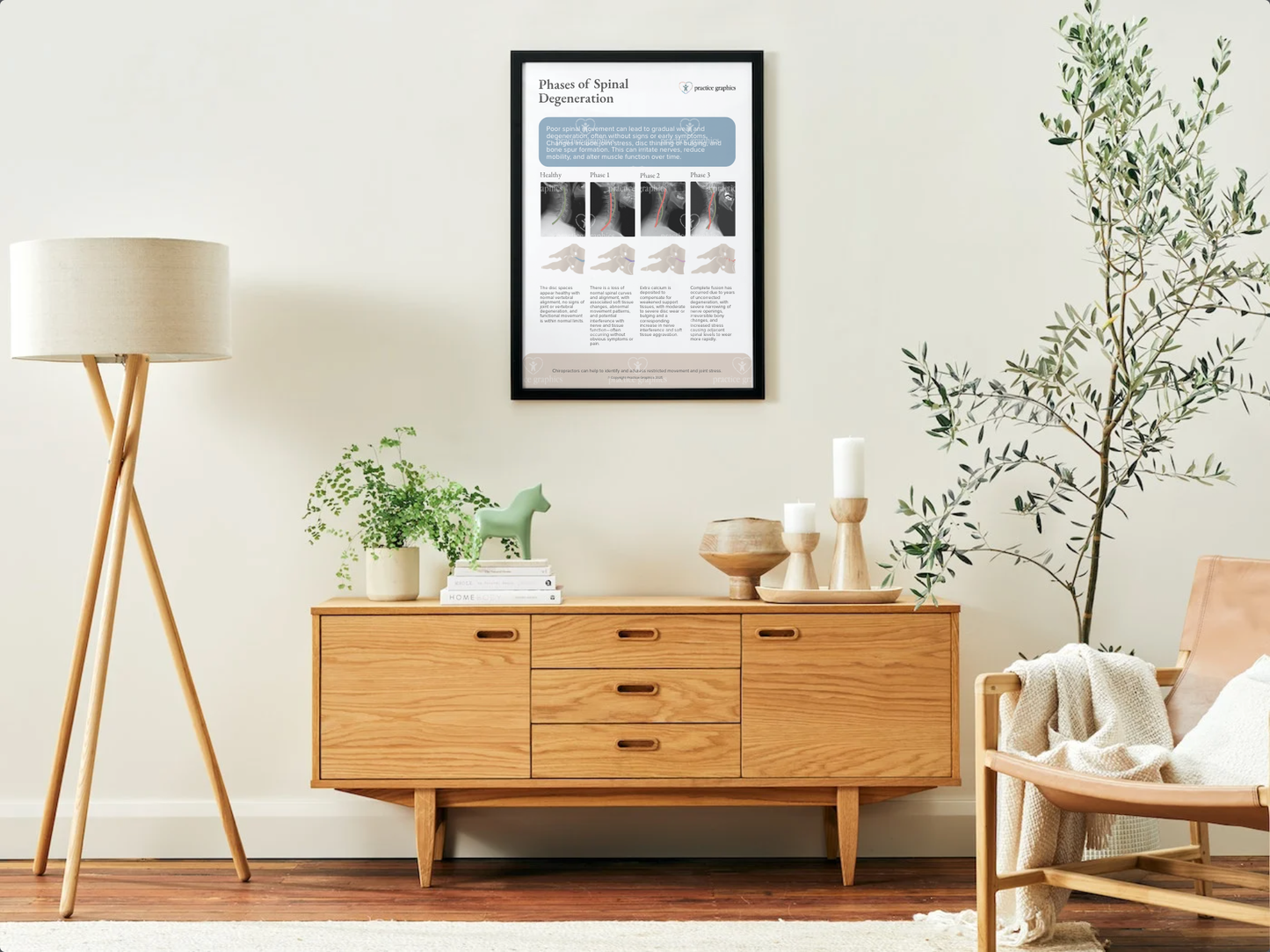 Phases of spinal degeneration Poster (xrays)