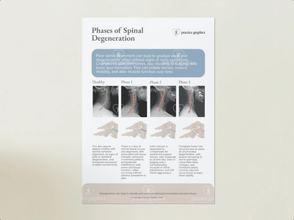 Phases of spinal degeneration Poster (xrays)