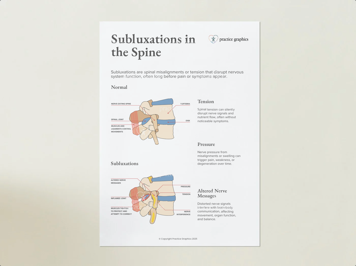 Subluxations in the spine Poster
